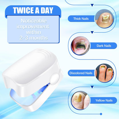 Rechargeable Nail Fungus Treatment for Toenail, Toe Nail Fungal Treatment Nail Fungus Laser Device, Anti-Fungal Nail Treatment for Hand &amp; Feet Infections Remover for Home Use